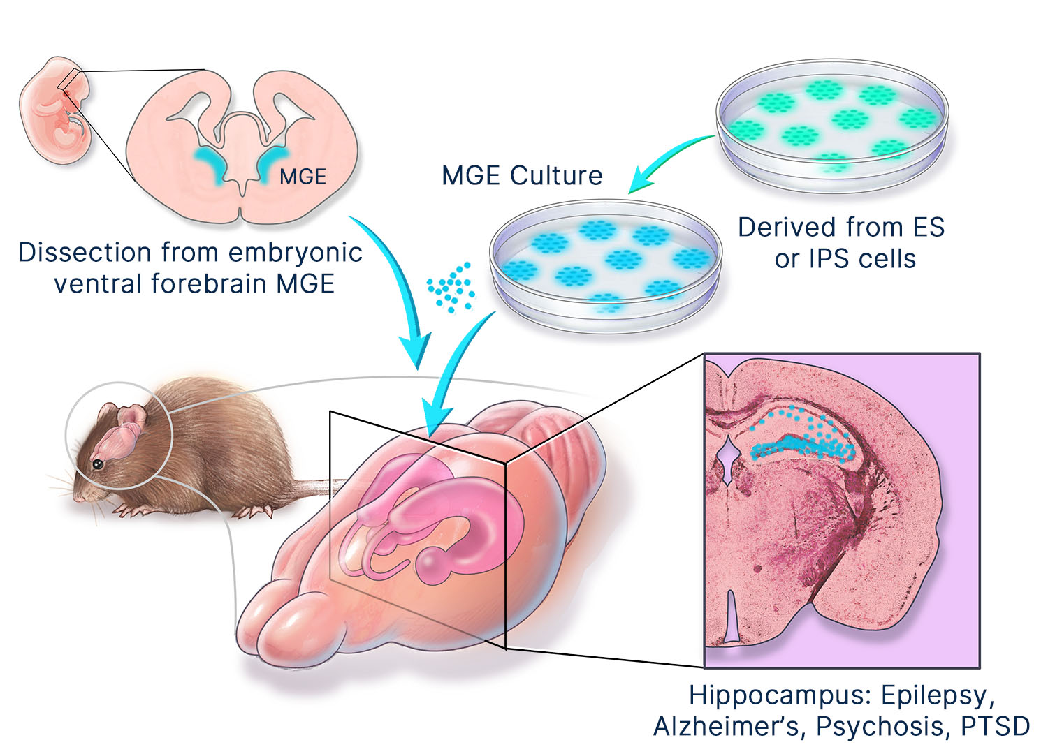 inter neuron transplantation graphic