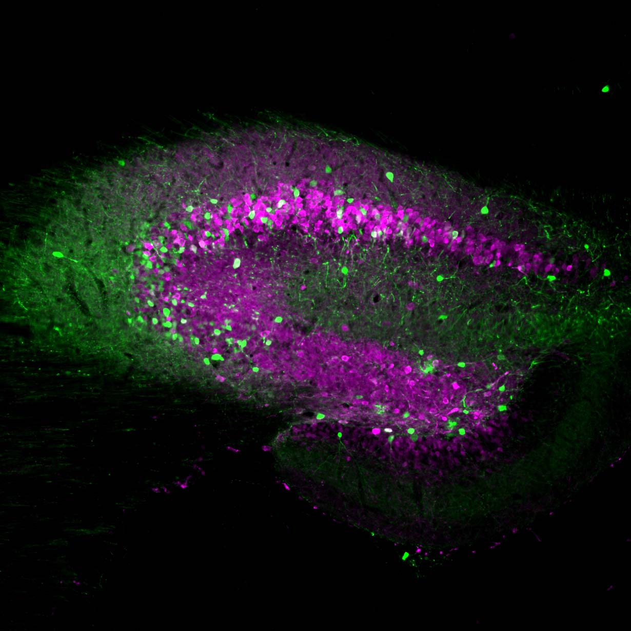 neural-cell photo